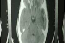 Brain X-Ray