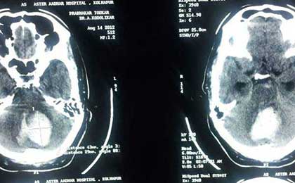 Pre OP CT