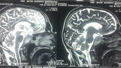 Endoscopic Surgery