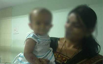 Hydrocephalus