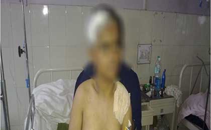 Paediatric Brain Tumors